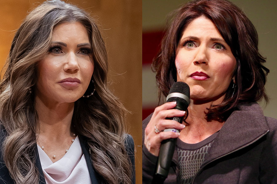 Speculation Continues Over Whether Kristi Noem Has Undergone Plastic Surgery